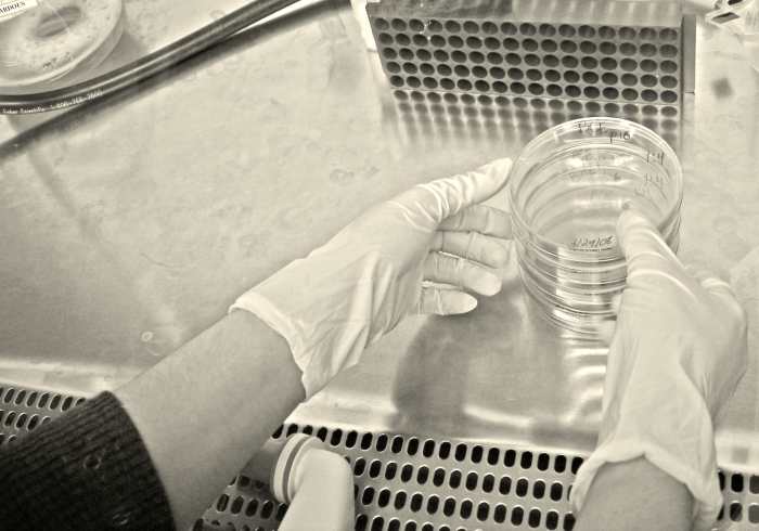 The culture and sensitivity test (C & S) identified a resistant strain of E. coli.