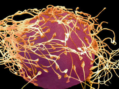 The right sperm and the right egg came together to bring you into existence. This had to happen thousands of times for you to exist, starting from the first living organism on earth.