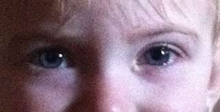My daughter when I first noticed her eyes were different. A little bit of extra eye junk and puffiness under the eyes.