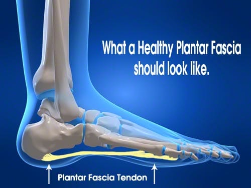 Not everyone is blessed with perfect feet, some people have high arches, while others have low arches or flat feet that can lead to heel pain, leg pain and even back pain.