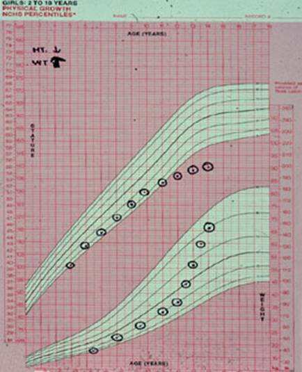 The top green portion of this chart shows a child on the smaller side since he was 2 years of age about the 5th percentile. The weight is indicated on the bottom portion of the chart. By 10 years of age this child was falling below the norms for the