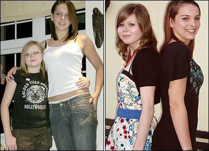 These twins on the left at age 12. You can see the smaller girl looks much younger than her twin as well as being significantly shorter. After treatment the girls appear much closer to the same age, and are closer to height.