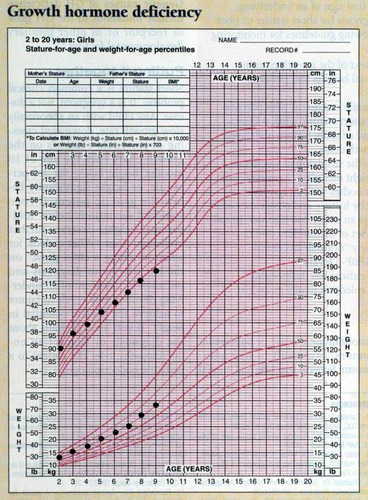 This growth chart indicates that the child was at the 75th percentile at 3 years of age and slowly fell to under the 5th percentile by age 9. This occurs very gradually, but is still indicative of a growth hormone issue and should be evaluated.
