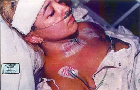 Darlie in the hospital with her wounds. This photo was taken in the ICU. Darlie must have put her earrings back in for the photo. Operating room staff remove ALL jewelry before any type of surgery and the nasal cannula tubing would rub on the earring