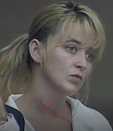Forensic pathologists have noted that Darlie's neck wound appeared to have at least 2 hesitation areas and it was crooked, indicating self infliction; where if this were a slash during a fight, it would most likely be a nonstop straight laceration.