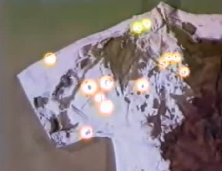 The boy's blood spatter (highlighted) suggestive of cast off blood from the knife at the right arm area of the nightshirt