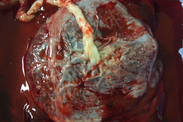 Human Placenta -People who dare it this believe that it prevents postpartum depression and other pregnancy complications. There are various recipes to prepare it, even cocktails and it is found mostly in America and Europe, Mexico, Hawaii, China, an