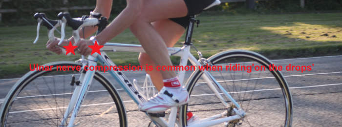 Ulnar nerve compression from cycling is more prominent whilst riding on the drops