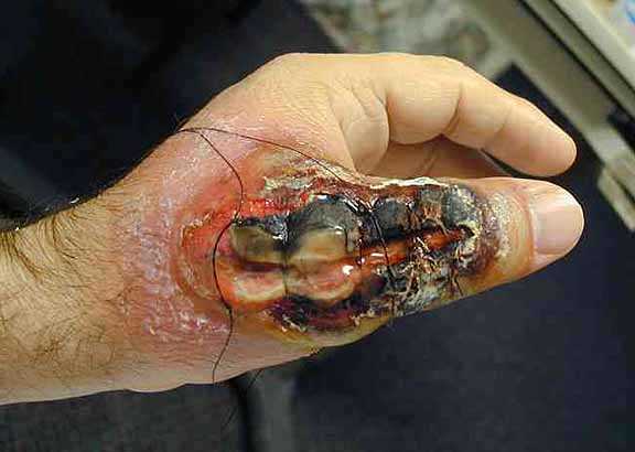 Peru Poisonous Spiders, Venomous Snakes, Bugs, Dangerous Animals, Insects, and Lethal Diseases