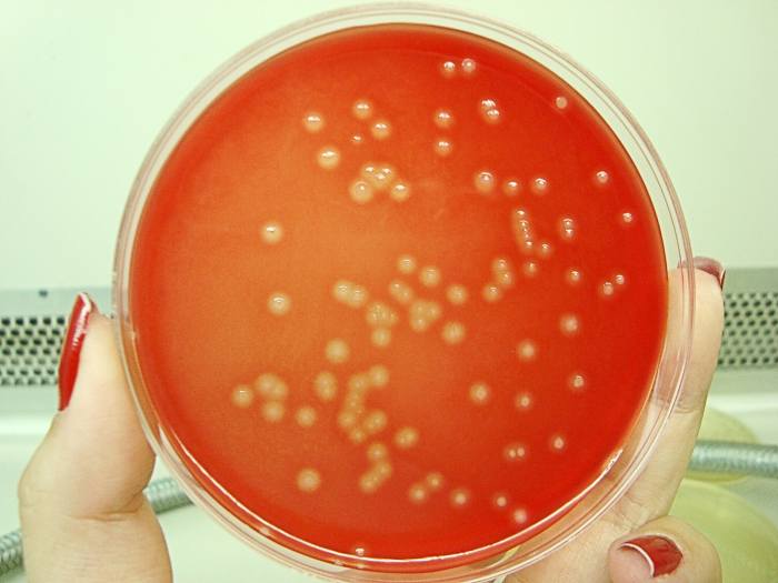 Streptococcus Bacteria in Groups A and B Facts and Diseases