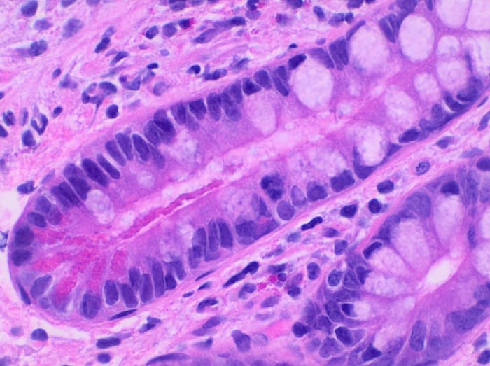 Stained Paneth cells (the large structures)