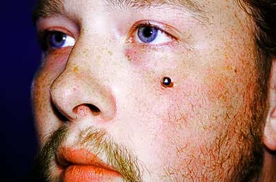 A nick piercing looks a bit like a dueling scar, which was popular in Austria at the turn of the 20th century.