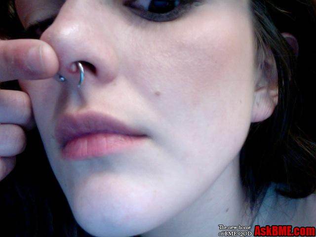 This is NOT the normal healing process. This is infected. (A little bit of swelling/a small bubble near the piercing site however IS normal for the first little while. Mine took a few months to disappear completely.)
