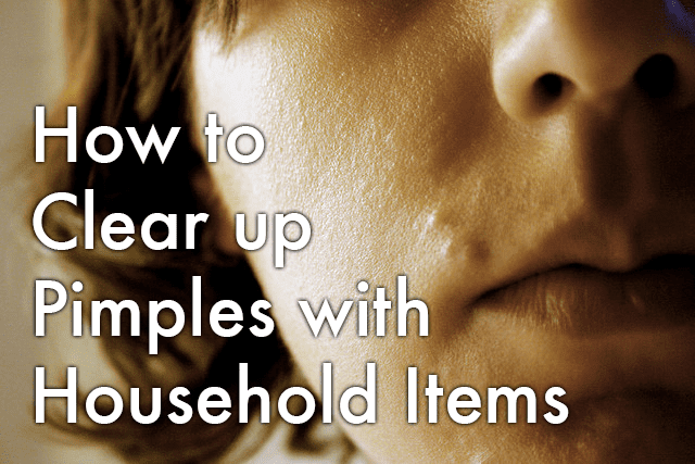 How to treat and prevent pimples with household items.