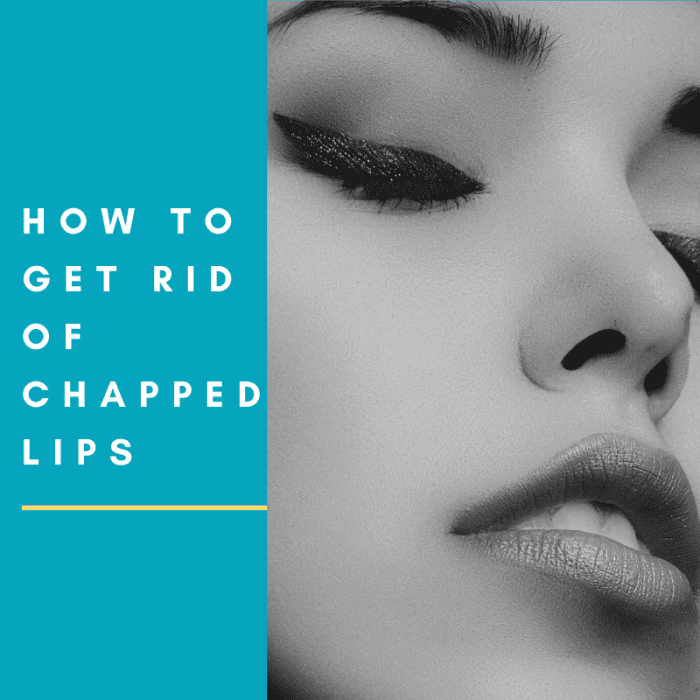 How to Get Rid of Chapped Lips with Easy Home Remedies HubPages