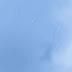 Floaters come in all shapes and sizes. They can be clear, as seen in the picture, or they can be grey or even black.