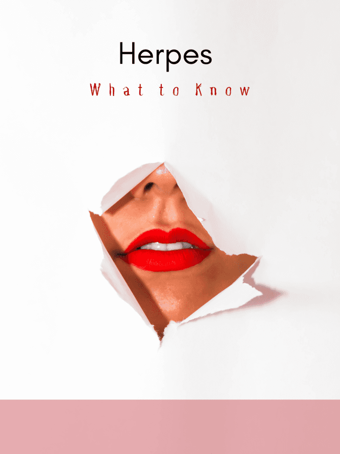 Herpes Facts, Symptoms, And Natural Remedies - RemedyGrove