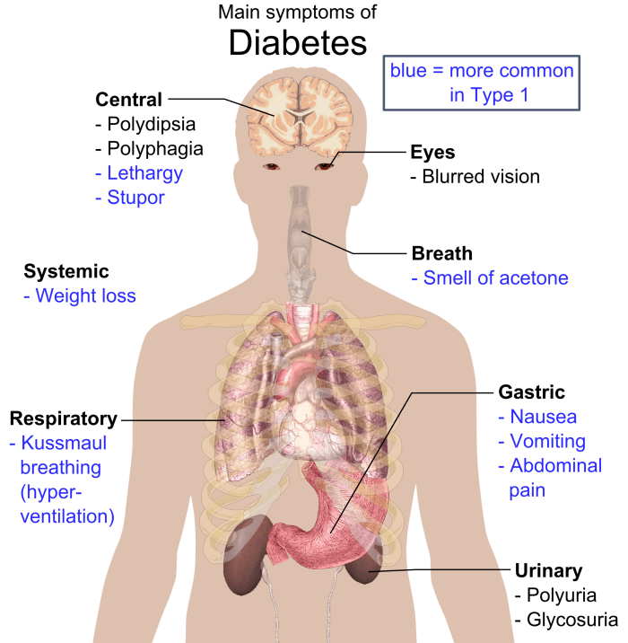 Some common symptoms of diabetes