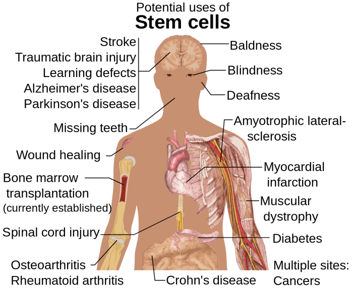 Stem cells may one day be used to treat diabetes.