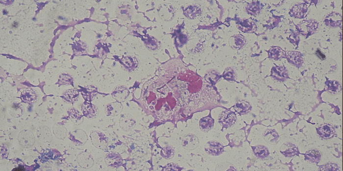 Caused by Pseudomonas pyocyanea, also known as Pseudomonas aeruginosa.