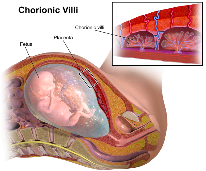 A sampling of the chorionic villus, part of the baby's placenta, allows for testing of the fetal chromosomes and more detailed genetic testing.