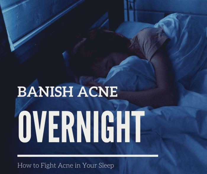 Read on to learn how to get rid of pesky pimples in your sleep!