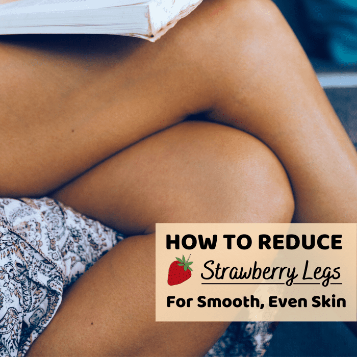 Does shaving make the pores on your legs stand out? Learn how to help prevent "strawberry legs" by changing your routine.