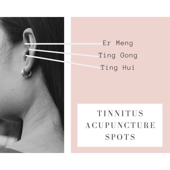 Do Natural Remedies for Tinnitus Work? RemedyGrove