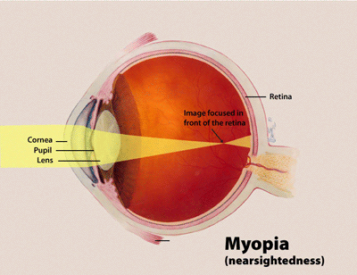 The lens at the front of your eye focuses light on the retina.