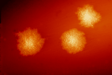 "C. difficile" colonies can sometimes run rampant after a course of antibiotics.