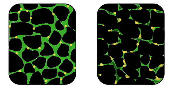 Affected muscle tissue on the right with reduced dystrophin (green) production compared to healthy tissue on the left.