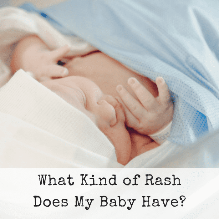 Discovering your infant has a rash can cause panic. What is it? Do you need to call a doctor? Here are four of the most common rashes.