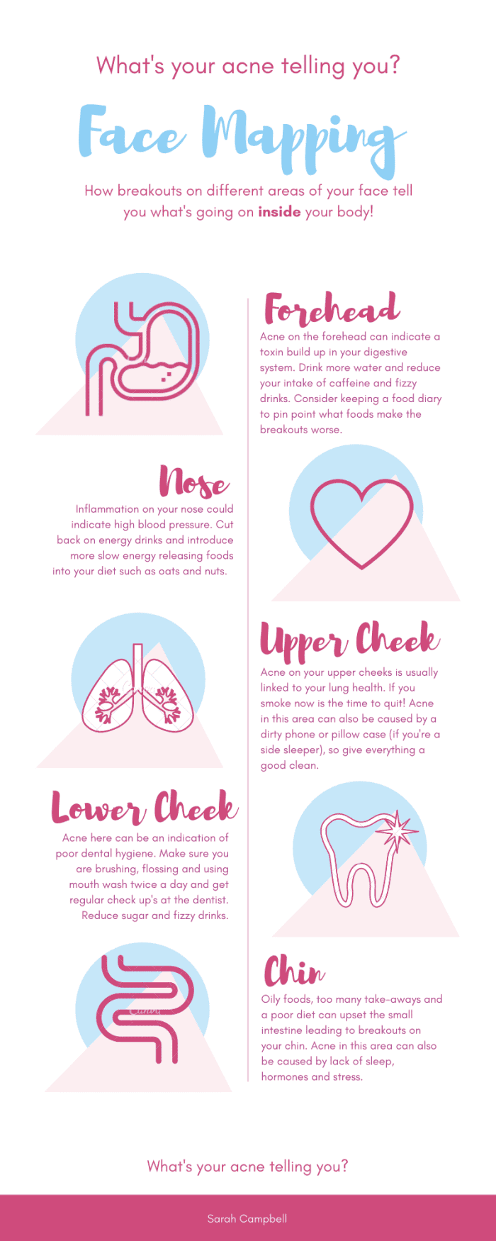 You can tailor your acne-prevention routine based on the areas most affected. Your body is talking to you.