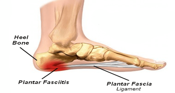 plantar-fasciitis-hiking-weather-proof-shoes