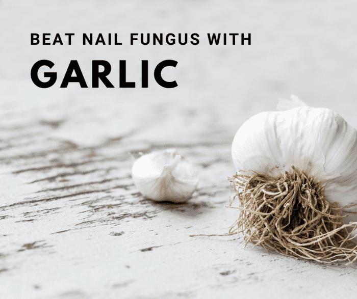 10 Natural Remedies to Get Rid of Nail Fungus Bellatory
