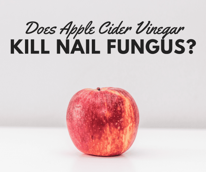 Banish nail fungus with ACV!