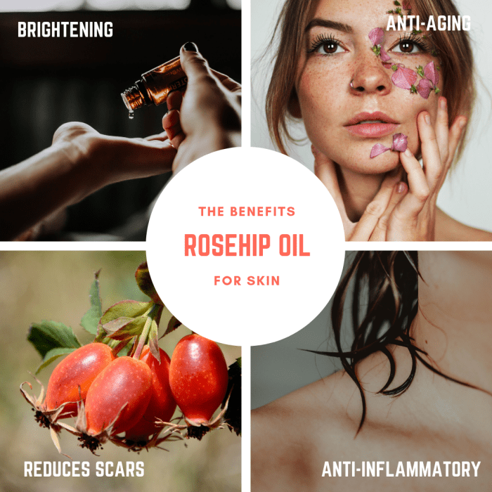 Rosehip oil offers many benefits and is all-natural.