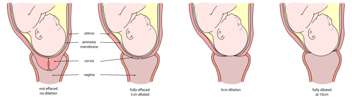 Cervix Effacement and Dilation: The cervix may begin to efface and dilate at this stage of the pregnancy.