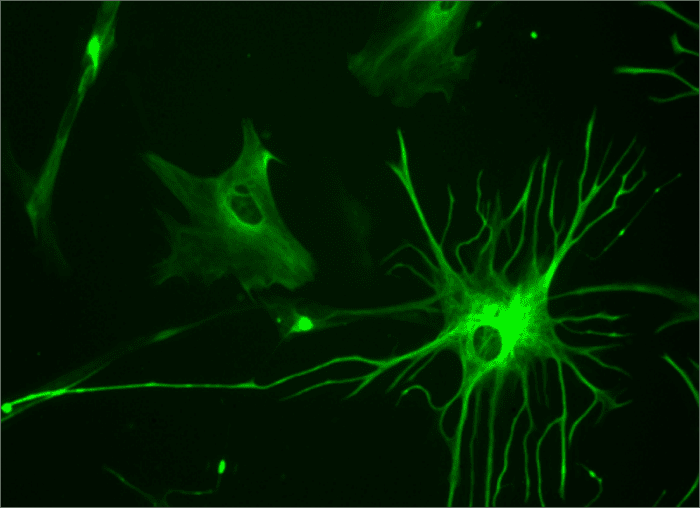 Structure Of A Neuron Owlcation