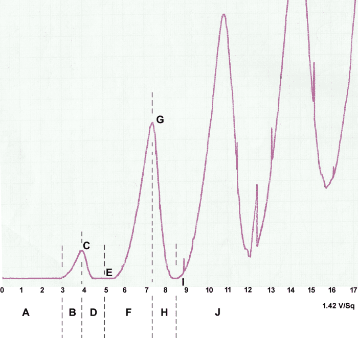 Data collected using mercury vapour heated to 150 Celsius within the Franck-Hertz tube. Current is plotted as a function of accelerating voltage. Note that the general pattern is important and not the sharp jumps which are simply experimental noise.