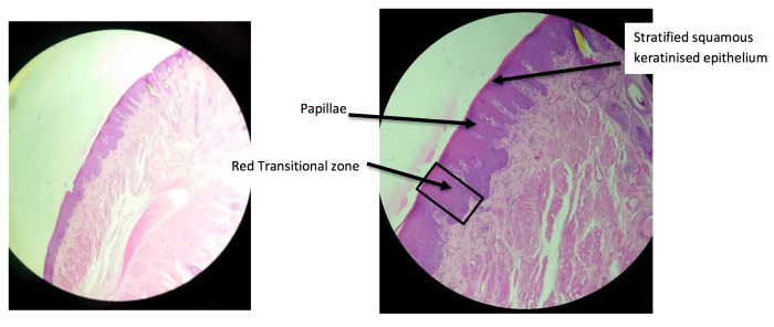 The red margin of the lip is a transitional zone between the outer skin and the inner mucous membrane.
