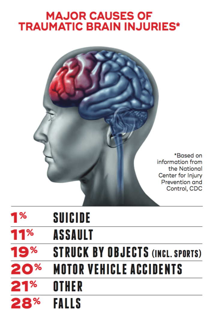 dissertations on brain injuries