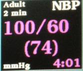 The blood pressure is displayed as the systolic over the diastolic. The MAP (mean arterial pressure) is in parentheses. This also provides important information to the anesthesiologist.