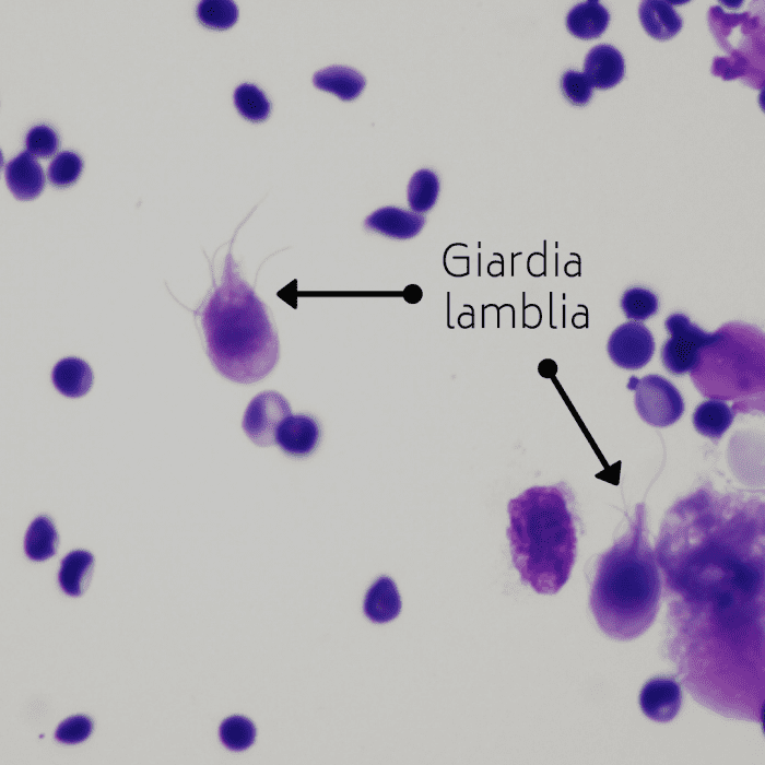 Стул при лямблиозе у детей