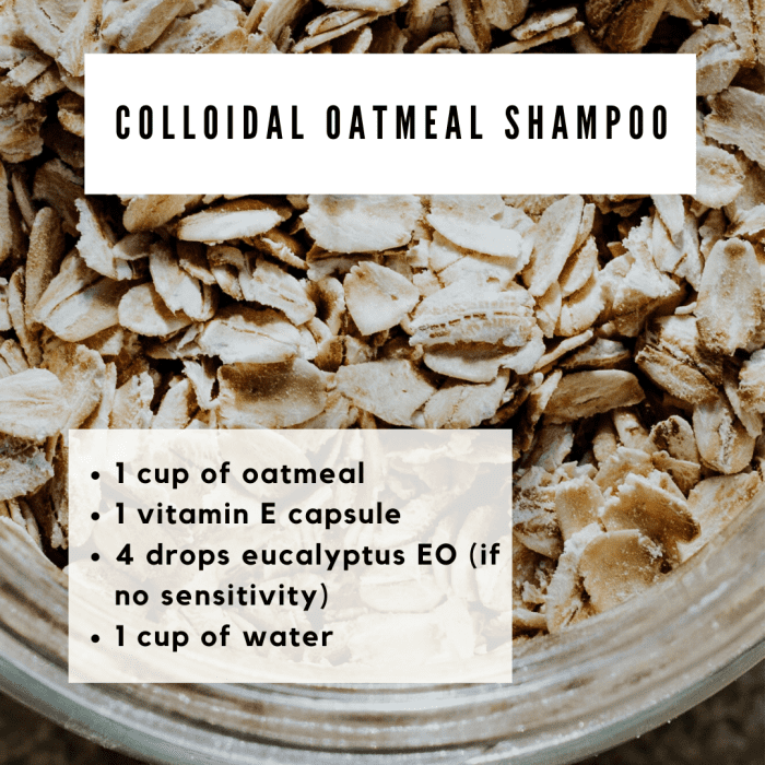 4 Types of Dandruff in Dogs & Easy Ways to Control It at Home PetHelpful