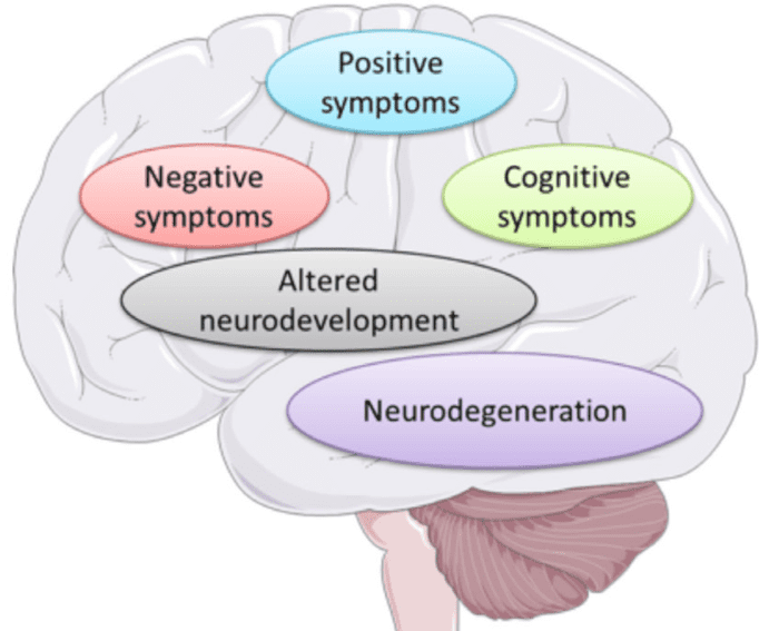 Before assuming Lia has schizophrenia, it is crucial to remember that the disease is only one possible cause of psychosis; a schizophrenia diagnosis is also contingent on the presence of a range of specific symptoms, not just delusions .