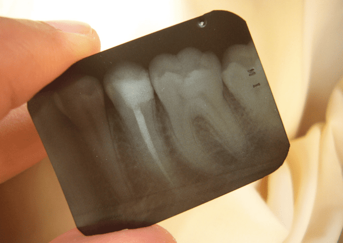 Before interpreting your dream of teeth, examine how it made you feel.