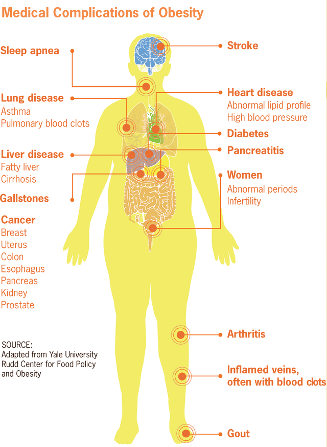 These are some of the conditions that occur when one is overweight. By the time one is obese (one third of body weigh carried in fat), one has entered into a state of serious disease.