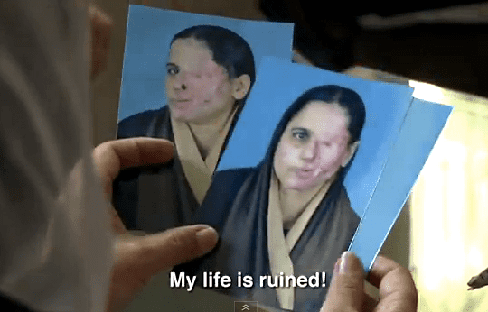 A still shot from the documentary "Saving Face". Zakia holds photos of her disfigurement by acid attack as she explains how her attacker (her husband) has not yet been punished.