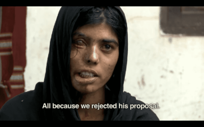 This woman was attacked with acid twice (once on her shoulder and later on her face) for rejecting a marriage proposal.